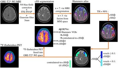 Regional Associations of Cortical Superficial Siderosis and β-Amyloid-Positron-Emission-Tomography Positivity in Patients With Cerebral Amyloid Angiopathy